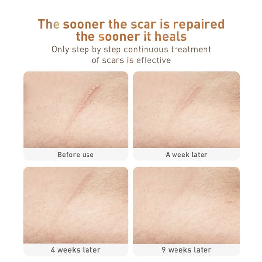 Scar Removal TCM Skin Care Cream